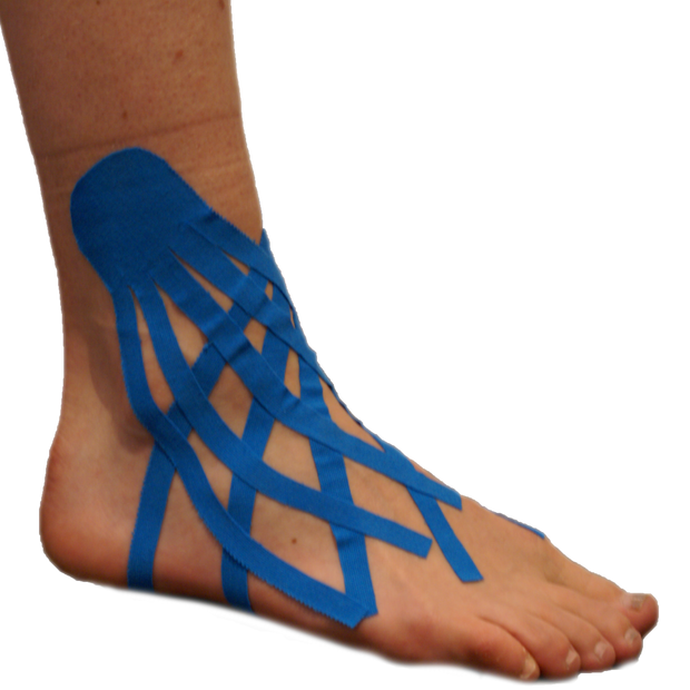 Repetitive Strain Kinesiology I-Strips (Synthetic)
